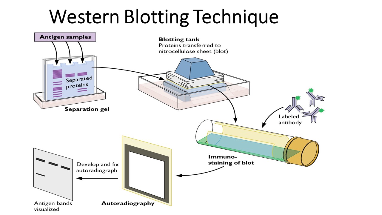 Western Blotting Technique Laboratory Analysis - vrogue.co