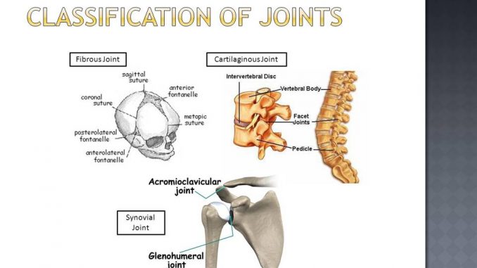 Joint Classification Chart