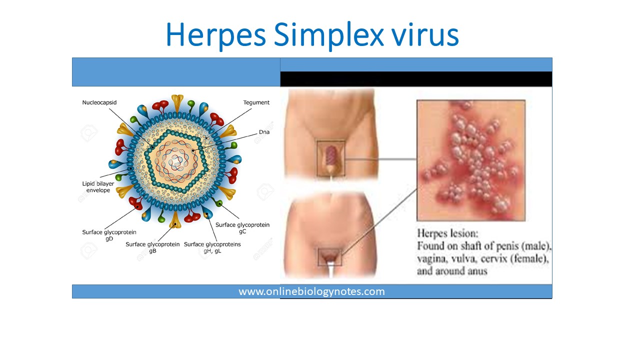 clinical presentation of herpes simplex virus