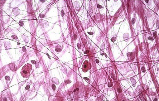 Dense Fibrous Connective Tissue Diagram