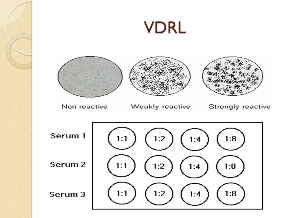 Тест psl r. VDRL тест. Реакция VDRL. VDRL RPR тесты. Venereal disease research Laboratory Test, VDRL.
