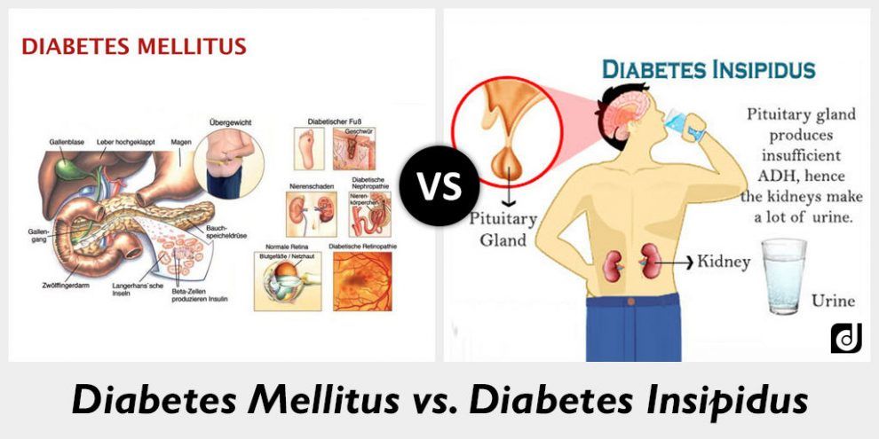 Difference between Diabetes mellitus and Diabetes insipidus - Online