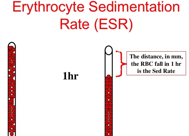 Flowchart showing study profile. ESR = erythrocyte sedimentation rate.