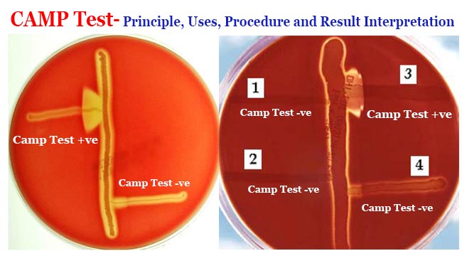 CAMP test showing half-moon shaped zone of complete hemolysis on a