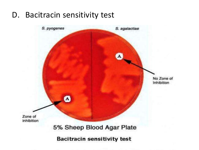 Тест на стрептококки в аптеке. Тест Бацитрацин. Стрептококки Бацитрацин тест. Тест с бацитрацином для стрептококка. Стрептококк агалактия.