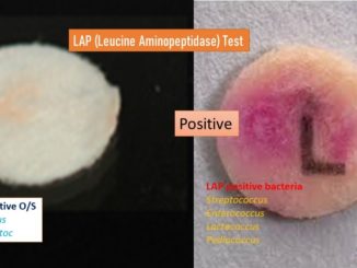 Leucine Amino Peptidase (LAP) test: Principle, Procedure and Results interpretations
