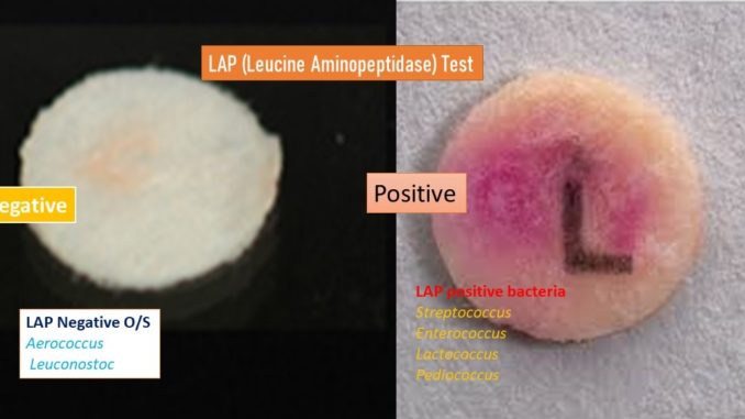 Leucine Amino Peptidase (LAP) test: Principle, Procedure and Results interpretations