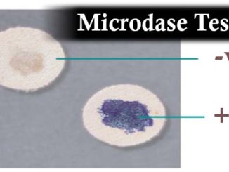 Microdase (Modified Oxidase) test: Principle, Procedure and Results interpretation
