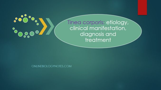 Tinea corporis- etiology, clinical manifestation, diagnosis and treatment